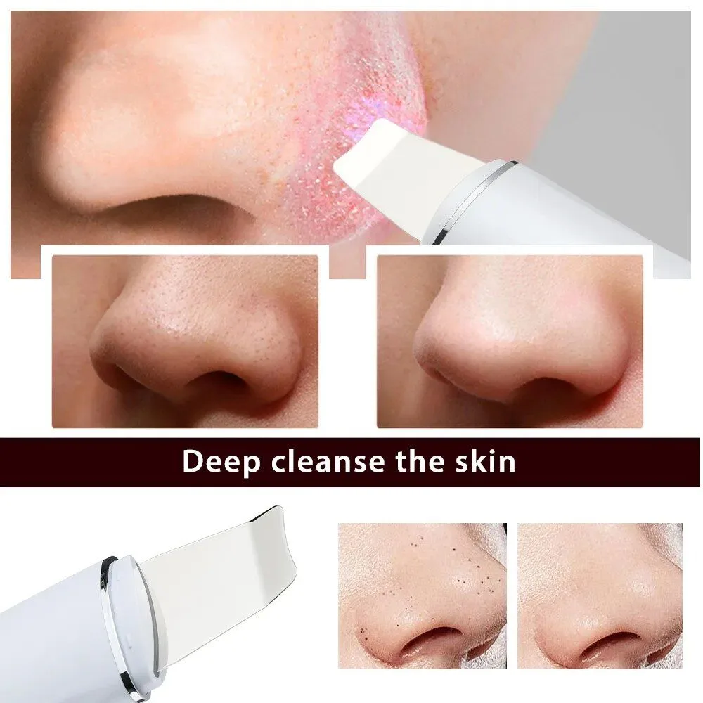 Ultrasonic Skin Scrubber Special Deals 